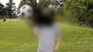 Degeneração macular: sintomas, riscos e cuidados essenciais