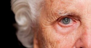 Cirurgia de catarata: entenda o procedimento, indicações e avanços modernos