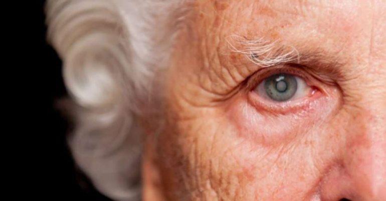 Cirurgia de catarata: entenda o procedimento, indicações e avanços modernos