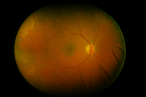 O Que é a Mácula? Entenda Sua Função Vital para a Visão Detalhada