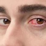 Doenças dos olhos: sintomas, causas e como prevenir problemas na visão