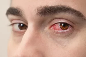 Doenças dos olhos: sintomas, causas e como prevenir problemas na visão