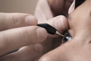 Paquimetria: por que medir a espessura da córnea muda o diagnóstico