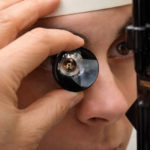 Gonioscopia: quando fazer e o que ela revela no glaucoma