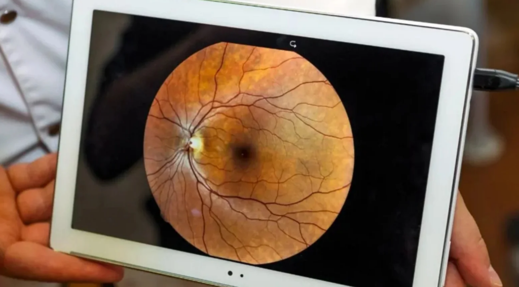 Retinografia Colorida: O Guia Completo para Iniciantes sobre o Exame