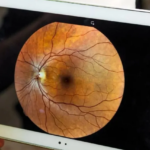 Retinografia Colorida: O Guia Completo para Iniciantes sobre o Exame