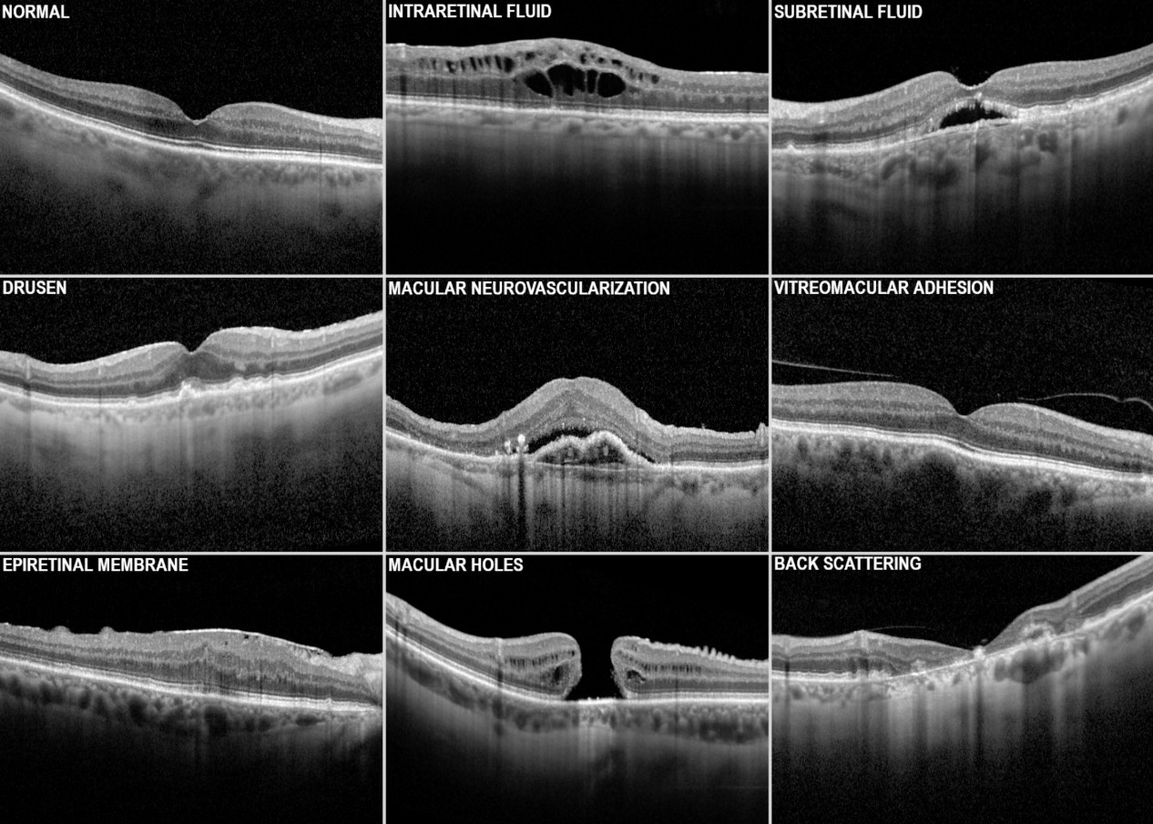 OCT: o exame que enxerga o que os olhos não mostram — Cuide da sua saúde ocular com acompanhamento especializado