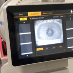 Biometria ótica antes da cirurgia de catarata: por que a precisão do cálculo da lente é tão importante?